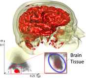 Brain classification